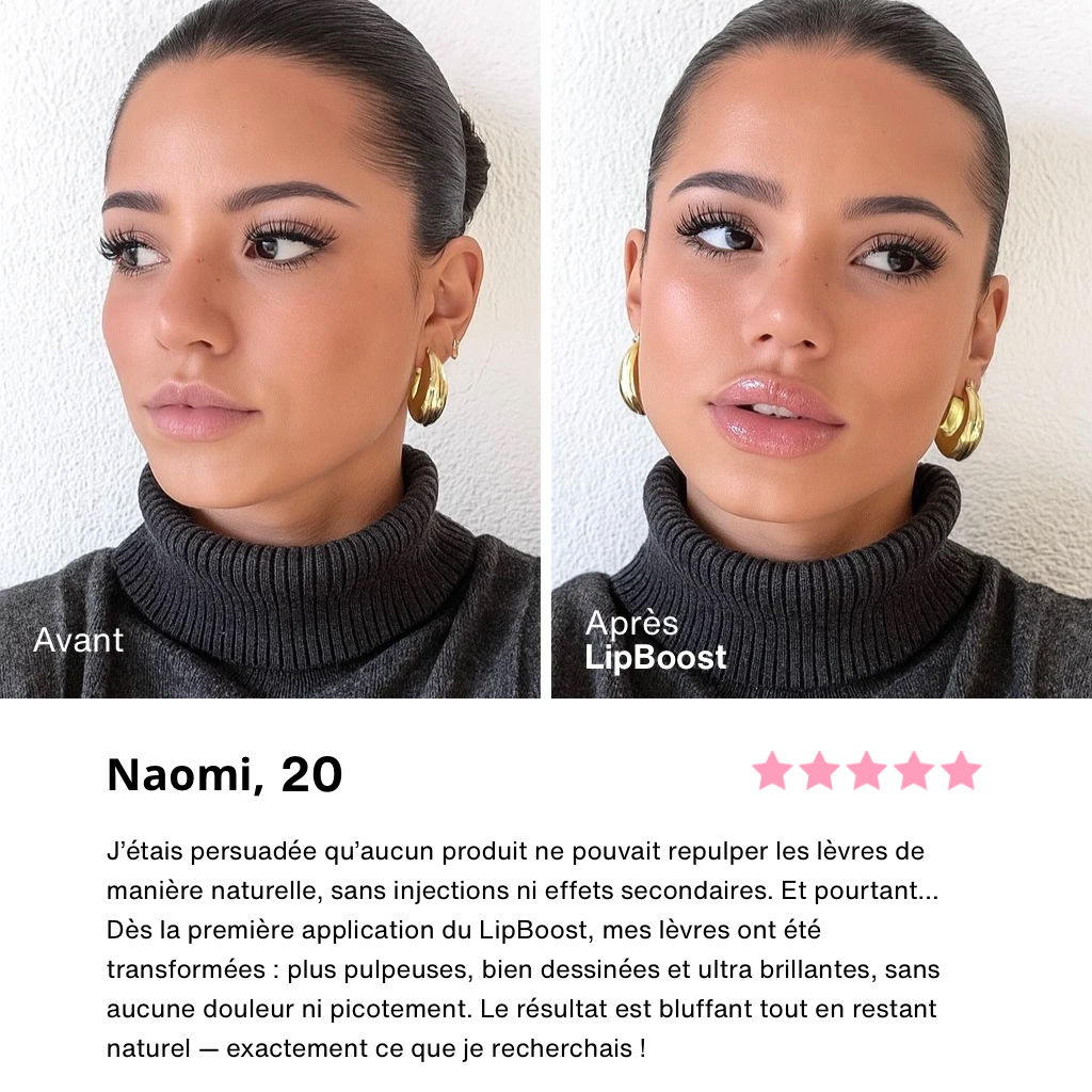 LipBoost - Microneedling Lèvres